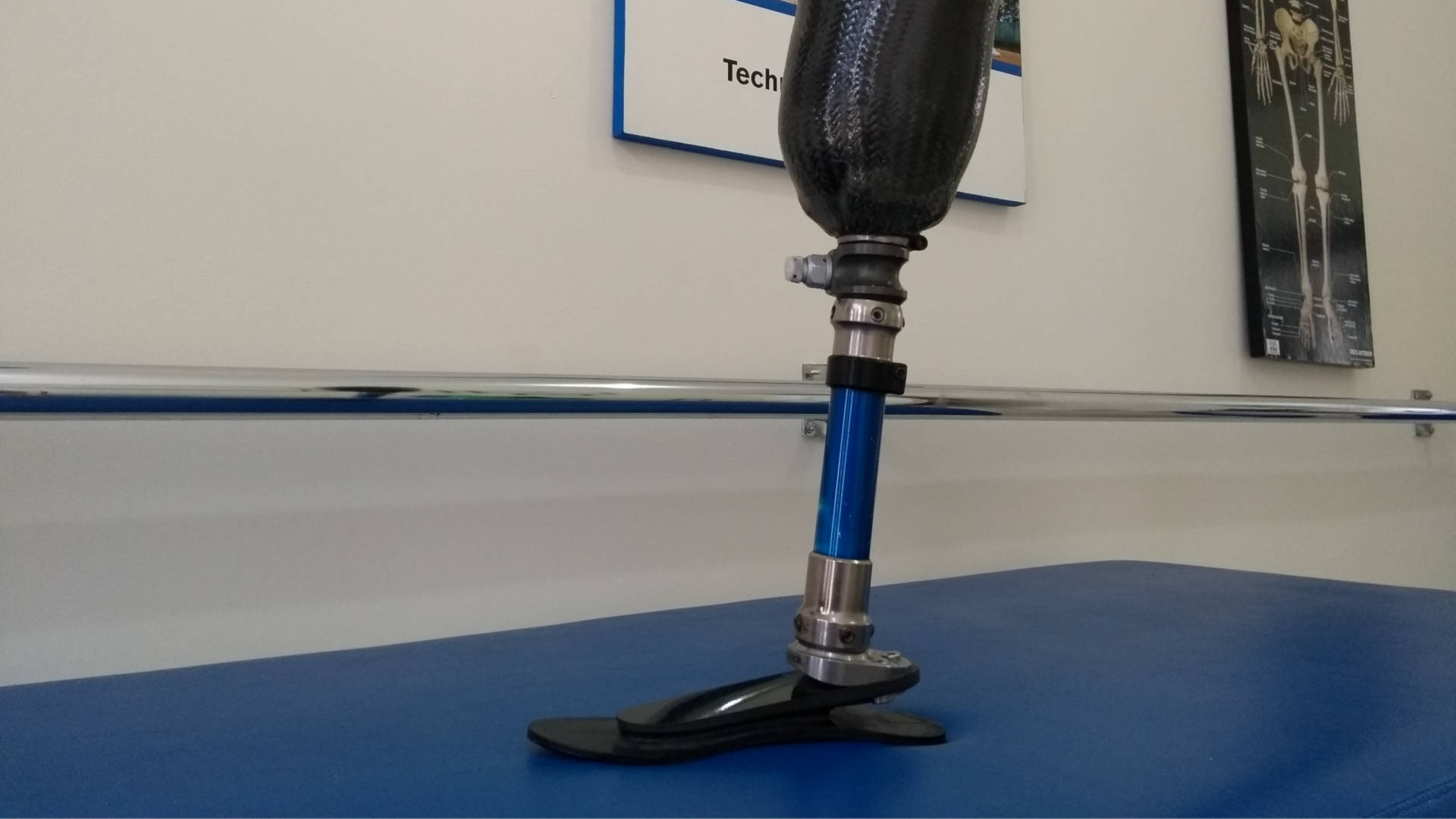 Protesis transtibial en carbono